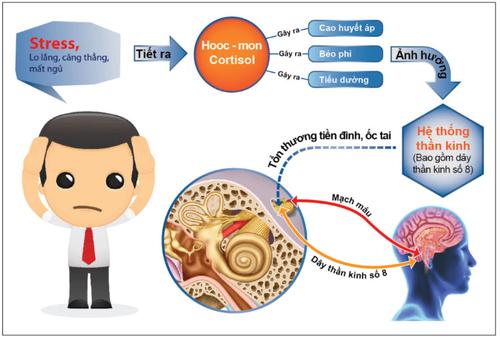 Căng thẳng, stress có thể gây rối loạn tiền đình