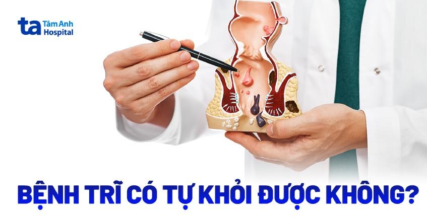 Bệnh trĩ có tự khỏi được không? Tự hết như thế nào?