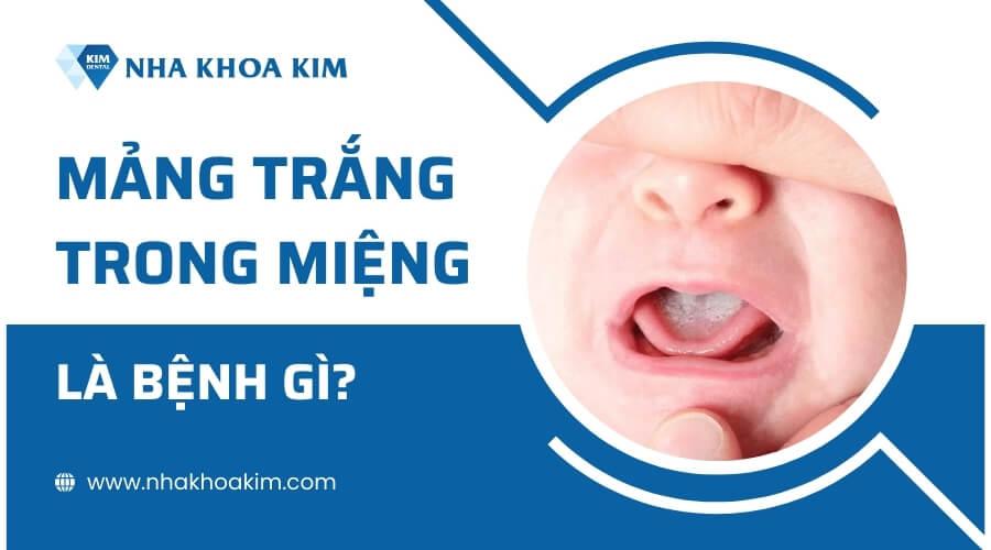 Mảng trắng trong miệng trẻ: Nguyên nhân và cách khắc phục