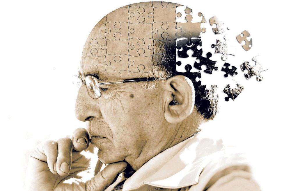 Nguồn gốc bệnh Alzheimer