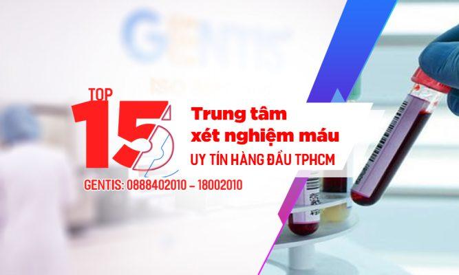 Tổng hợp 15 địa chỉ xét nghiệm máu uy tín  tại TpHCM