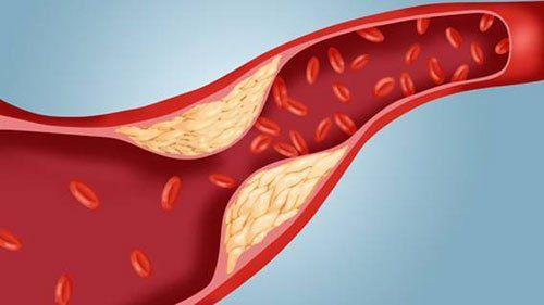 Niacin (vitamin B3): Công dụng, liều dùng, tác dụng phụ