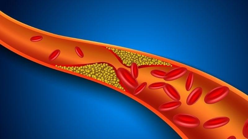 Uống nước vỏ chanh có tác dụng gì? 15 công dụng và lưu ý