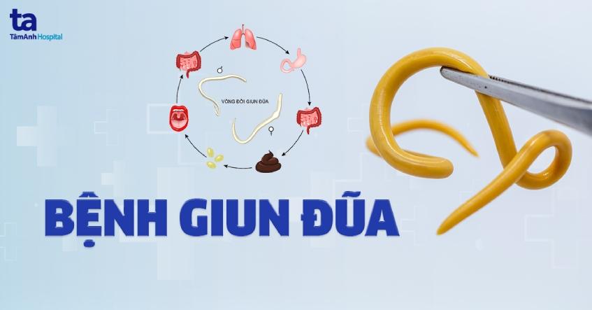 Bệnh giun đũa: Nguyên nhân, triệu chứng, chẩn đoán, phòng ngừa