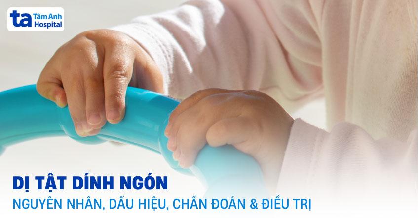 dị tật dính ngón